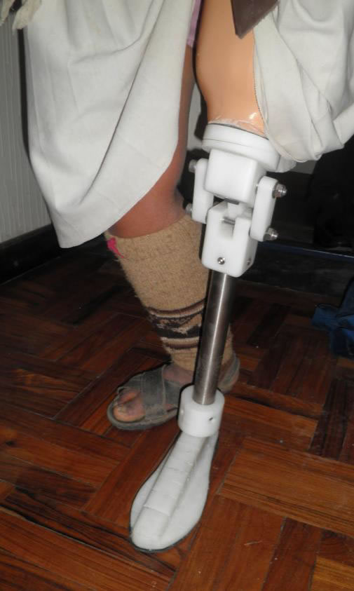 Prosthetic Leg